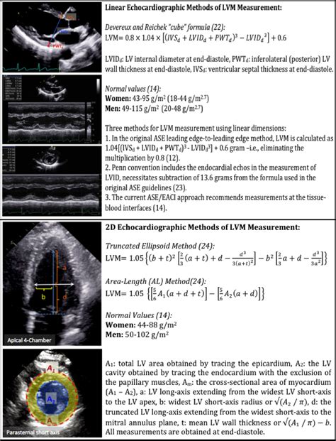 aodd lad lv mass|THE AMERICAN SOCIETY OF ECHOCARDIOGRAPHY .